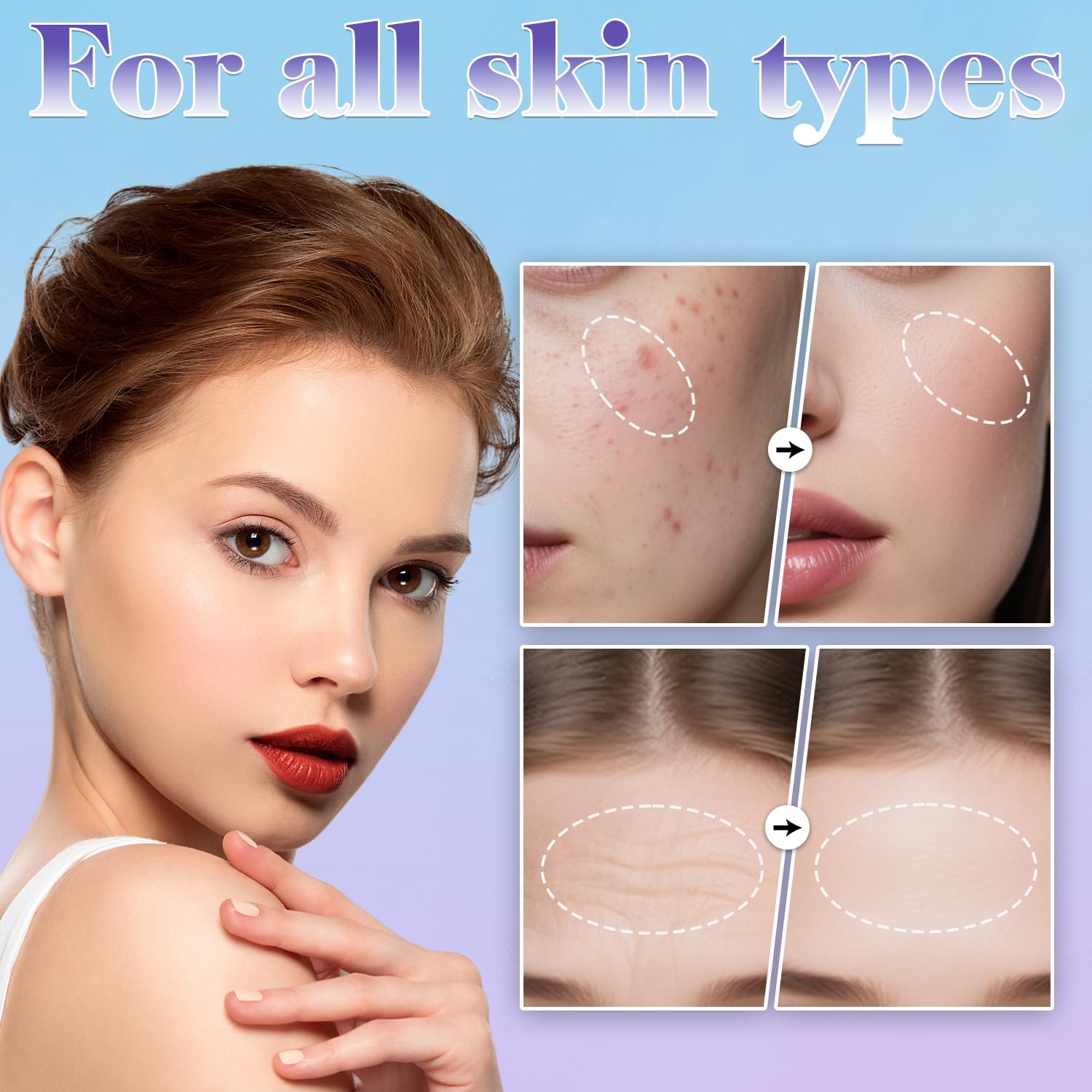 Derma Stamp - Uaike Microneedling Derma Roller Stamp,Microneedle Dermastamp | Home Use - for Women and Men