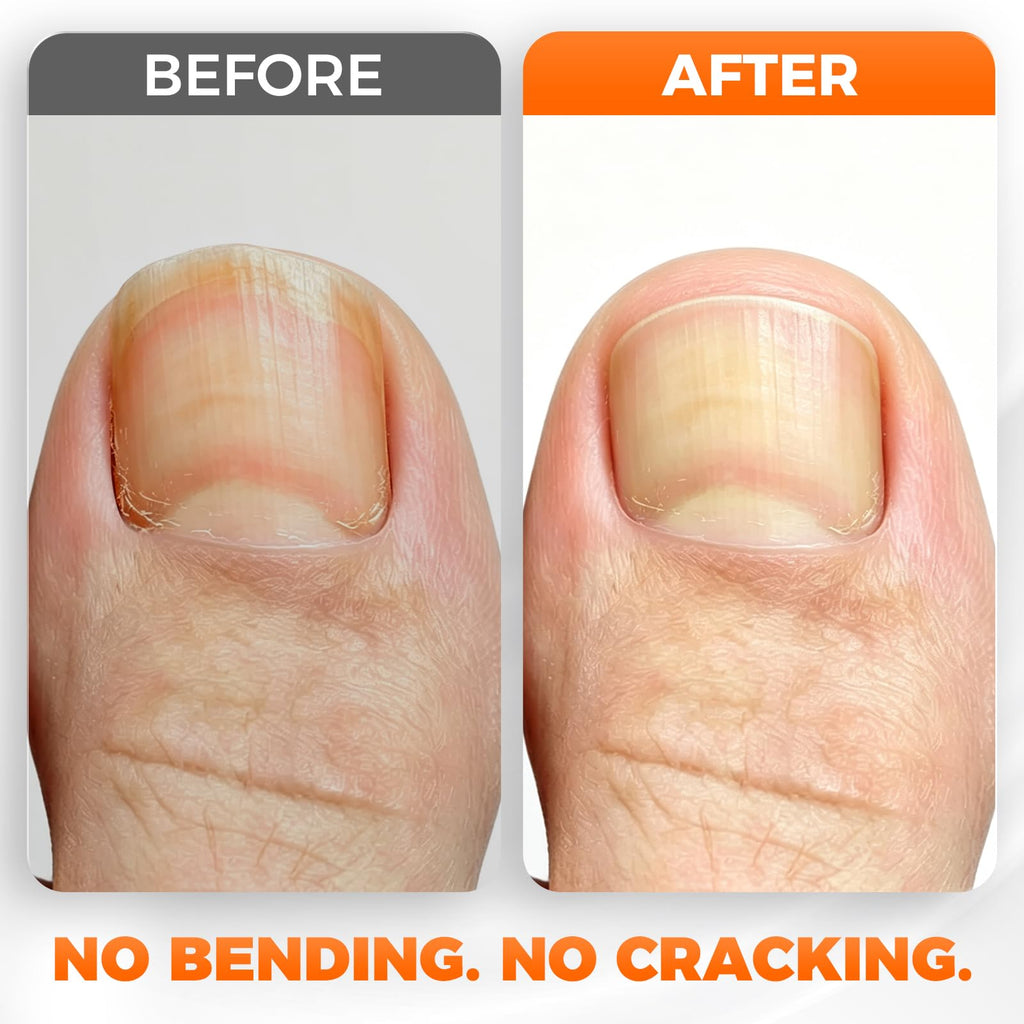 DRMODE Nail Clippers for Thick Nails Angled Head | Toenail Clippers for Thick Toenails Wide Jaw Opening, Sharp Toe Nail Clipper Cutter for Men with Catcher,Large,Heavy Duty