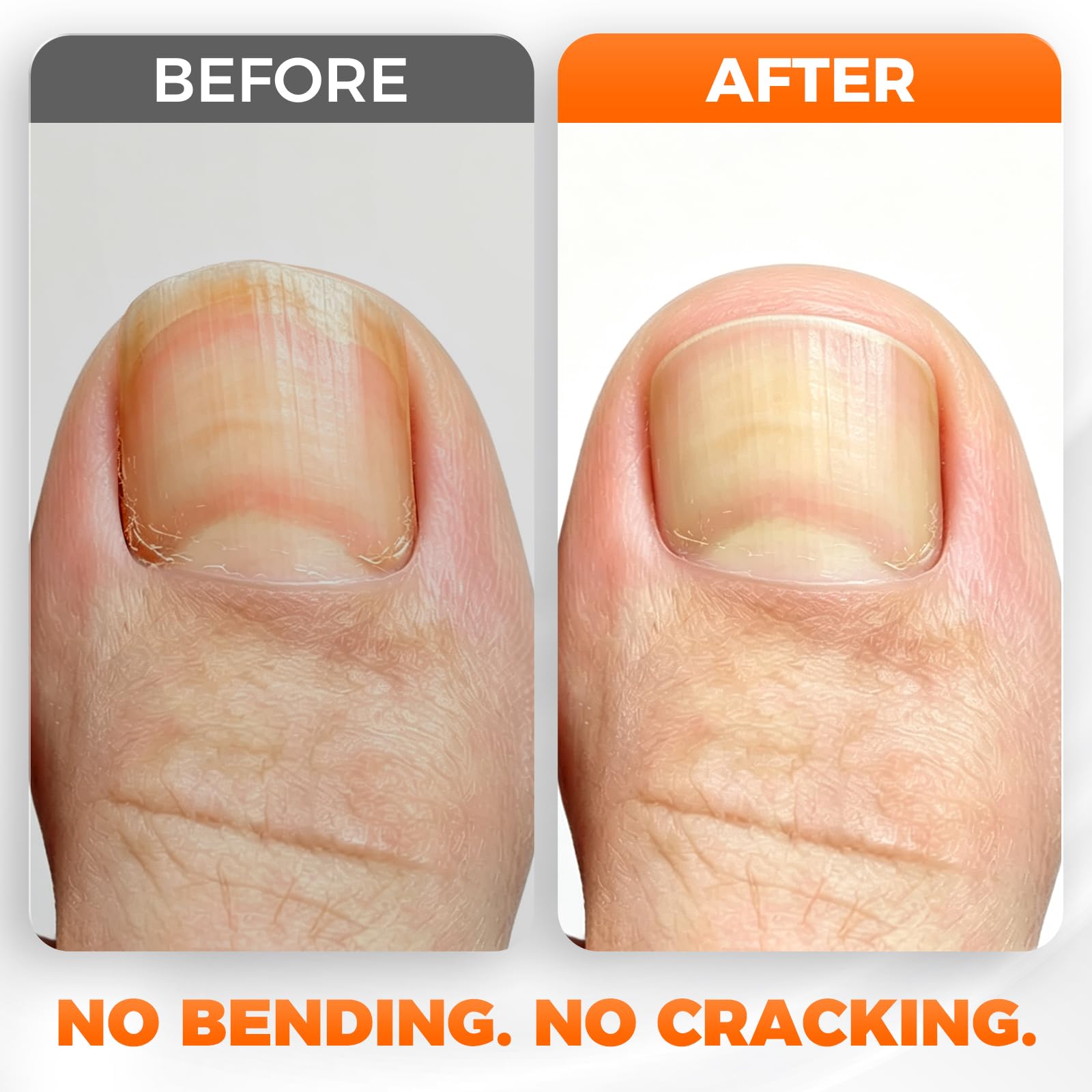 DRMODE Nail Clippers for Thick Nails Angled Head | Toenail Clippers for Thick Toenails Wide Jaw Opening, Sharp Toe Nail Clipper Cutter for Men with Catcher,Large,Heavy Duty