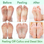 5 Pack Foot Peeling Mask,Exfoliator Peel Off Calluses Dead Skin Callus Remover,Foot Mask for Dry Cracked Feet,Foot Peel Masks for Men and Women,Feet Peeling Mask,Spa Gifts for Women,Self Care Gifts