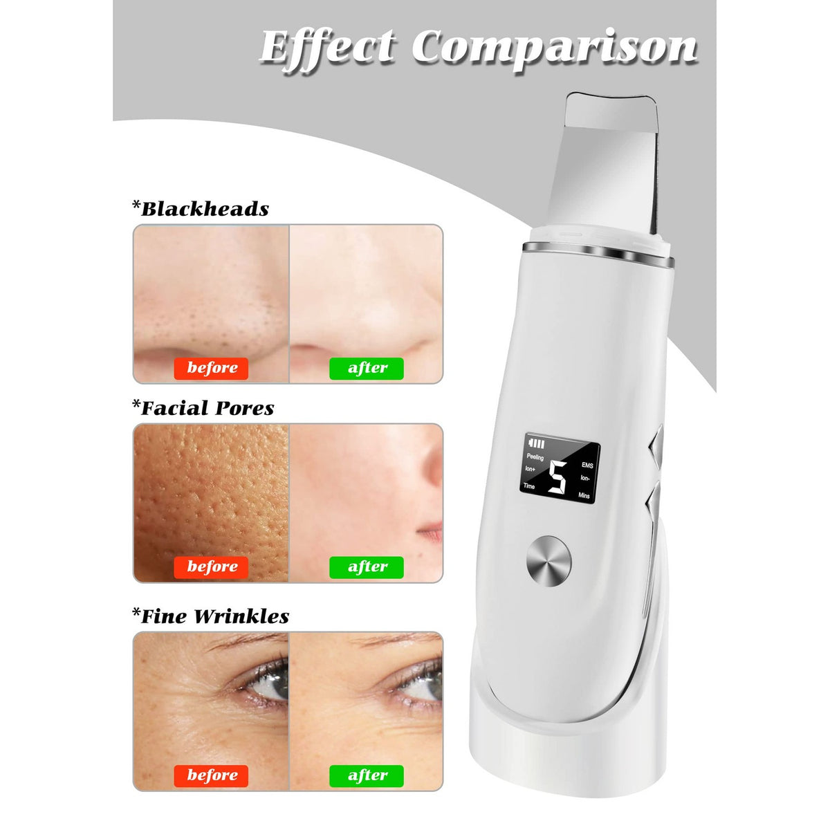 Skin Scrubber Face Spatula, 4 in 1 Blackhead Remover Tool for Pore Cleaner, Skin Scrubber Face Spatula for Facial Deep Cleansing with USB Charger