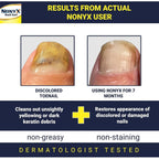 Buy now NONYX Fungal Nail Clarifying Gel | Clinically Proven for Discolored, Thick, Brittle, Yellow, Lifted, and other signs of Fungus-Damaged Toenails | 90% of Nails Improve | Over 8 million sold at indiglob india
