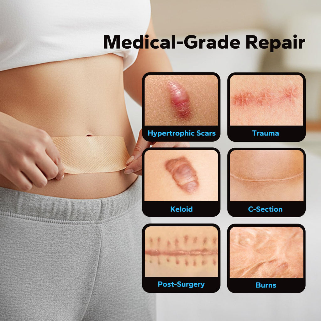 Silicone Scar Sheets (1.6" x 60" Roll - 1.5M), Silicone Scar Tape, Silicone Scar Sheets for Surgical Scars, Keloids & C-Section Scars, Reusable & Washable Scar Patches for Face & Body