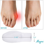 Buy now Bunion Corrector for Women and Men - Bunion Pads Pain Relief Gel Toe Separator Guard Big Toe Spreader Cushion to Wear in Socks and Shoes- Orthopedic Bunion Brace to Avoid Hallux Valgus Surgery(1 Pair) at indiglob india