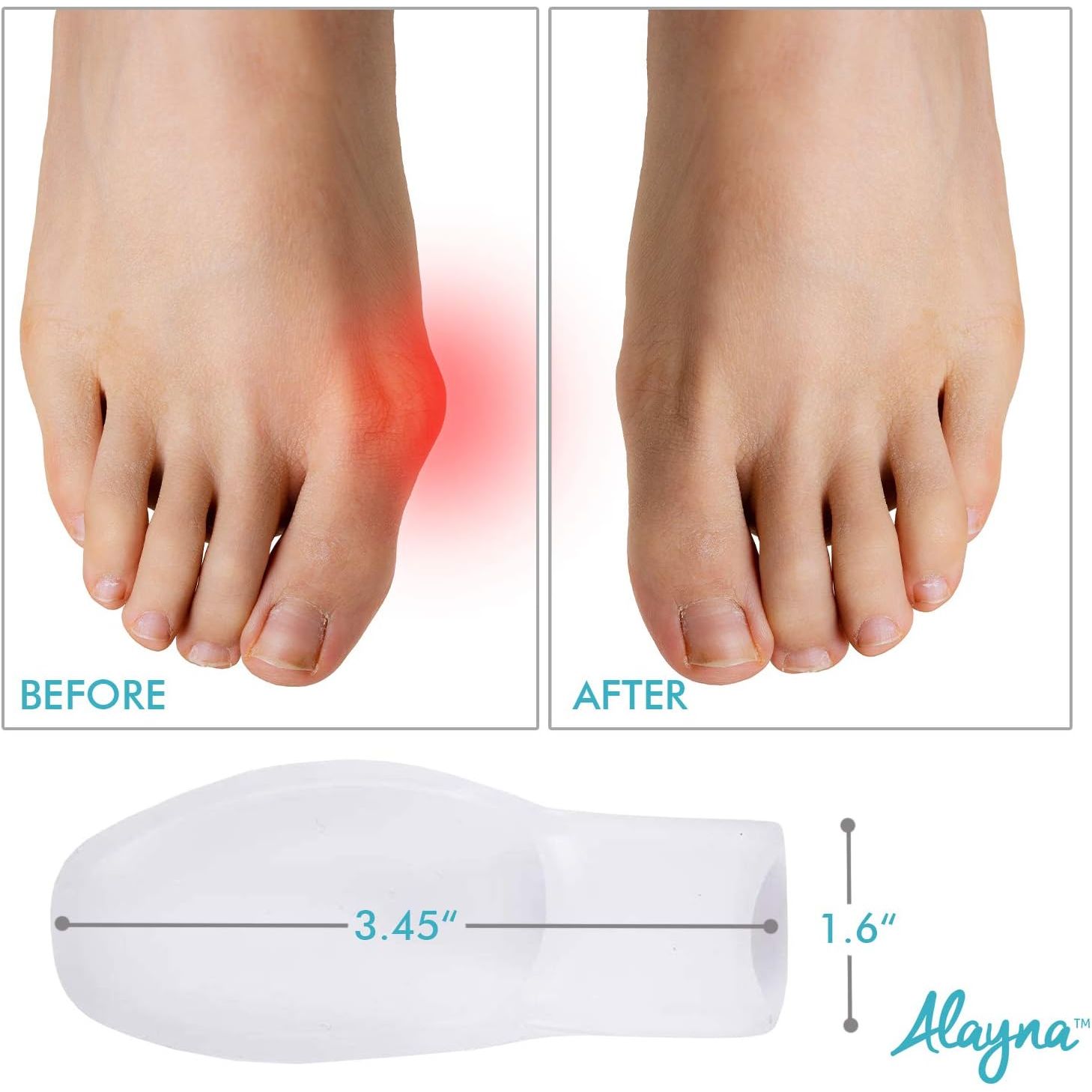 Buy now Bunion Corrector for Women and Men - Bunion Pads Pain Relief Gel Toe Separator Guard Big Toe Spreader Cushion to Wear in Socks and Shoes- Orthopedic Bunion Brace to Avoid Hallux Valgus Surgery(1 Pair) at indiglob india