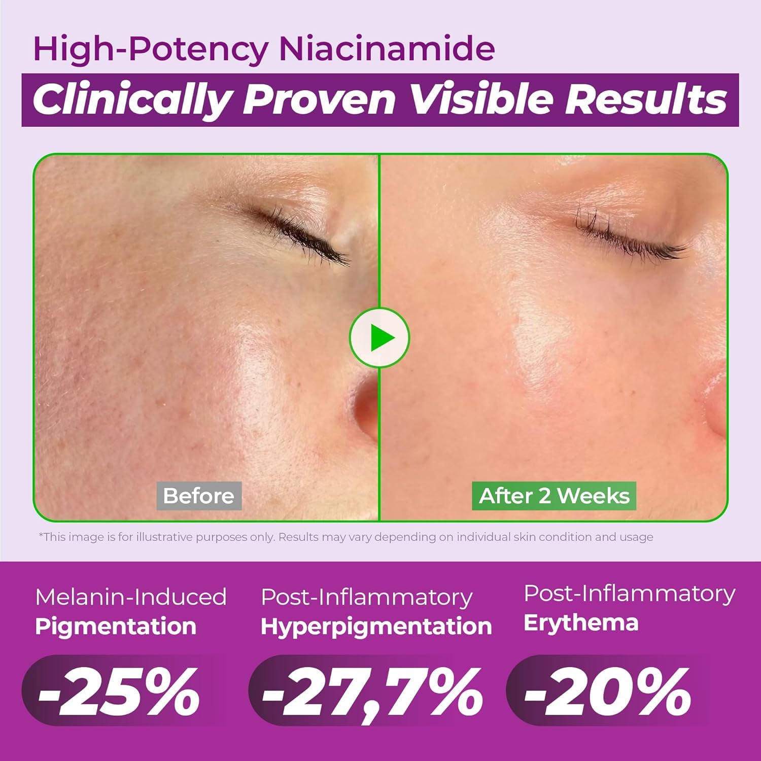 JUMISO 20% Niacinamide Dark Spot Correcting Serum for Face, 1.35 fl oz | TXA, Glutathione, Hexylresorcinol & Centella – Pore Care, Post-Blemish Marks, Glass Skin, Fragrance-Free