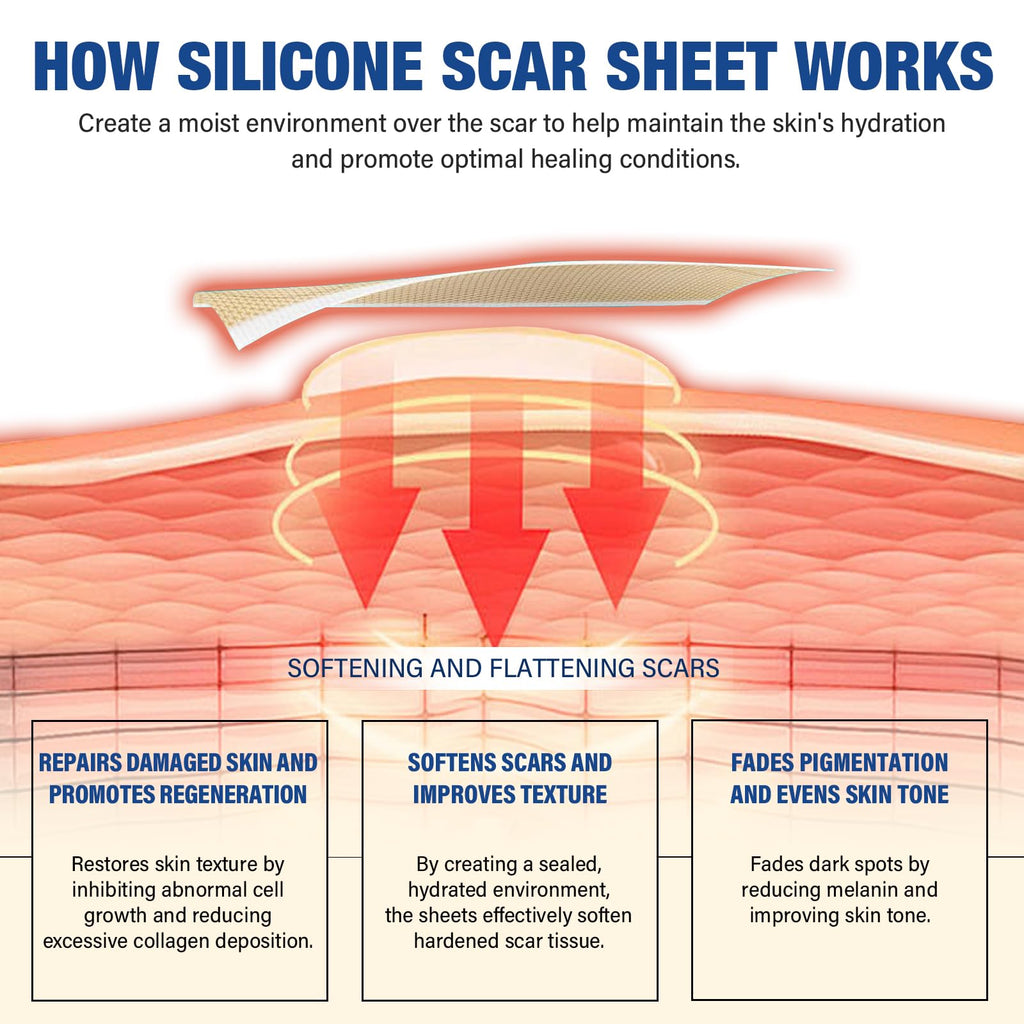 Silicone Scar Sheets, Silicone Scar Tape(1.6"x 158" Roll-4 meters), Silicone Scar Sheets for Surgical Scars, Scar Tape for Surgical, C-Section, Burn, Hypertrophic & Keloid Scars
