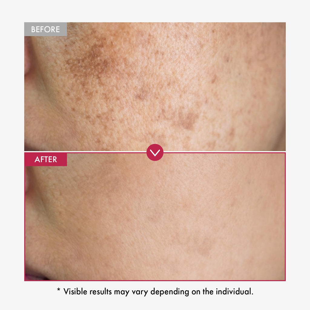 TOSOWOONG Niacinamide 10% + Tranexamic Acid 4% Serum for Radiant Glass Skin