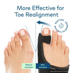 Caretras 2-Pack Bunion Corrector for Women & Men, Orthopedic Bunion Splint for Hallux Valgus Pain Relief, Big Toe Separator, Adjustable Day/Night Support, Comfortable Hammer Toe Straightener
