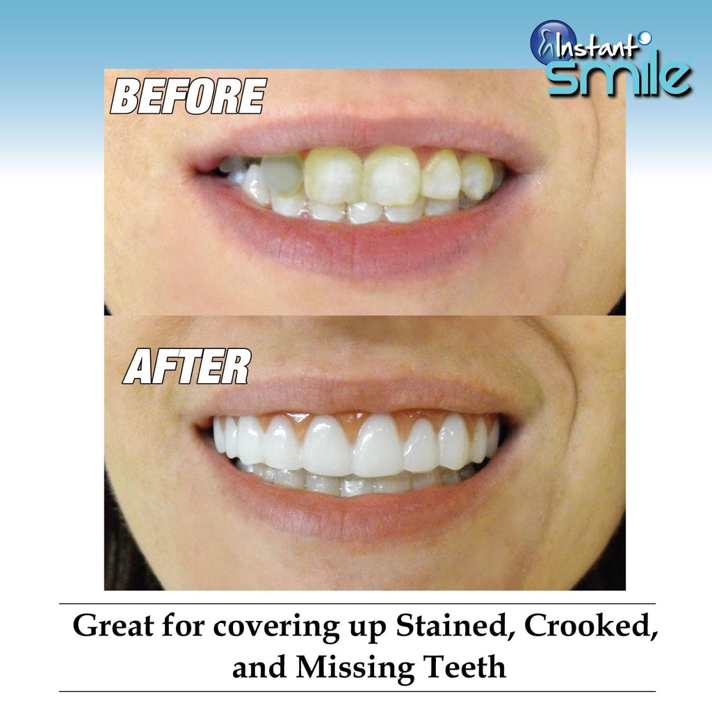 Instant Smile Comfort Fit Flex - Bright Shade - Upper Veneer Cosmetic Teeth