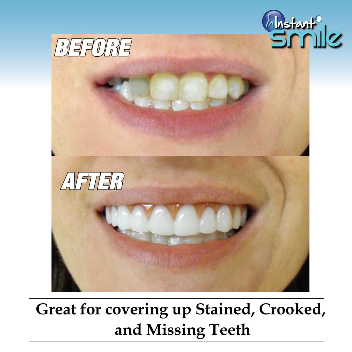 Instant Smile Comfort Fit Flex - Bright Shade - Upper Veneer Cosmetic Teeth