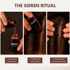 SØREN Micro Infusion Hair Renewal System by SOREN – Saw Palmetto & Peptide Scalp Treatment Kit | Supports Fuller, Thicker-Looking Hair | Gold Microinfuse Applicator | 3 Month Supply