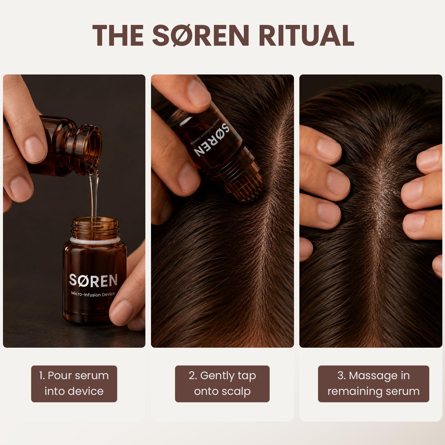 SØREN Micro Infusion Hair Renewal System by SOREN – Saw Palmetto & Peptide Scalp Treatment Kit | Supports Fuller, Thicker-Looking Hair | Gold Microinfuse Applicator | 3 Month Supply