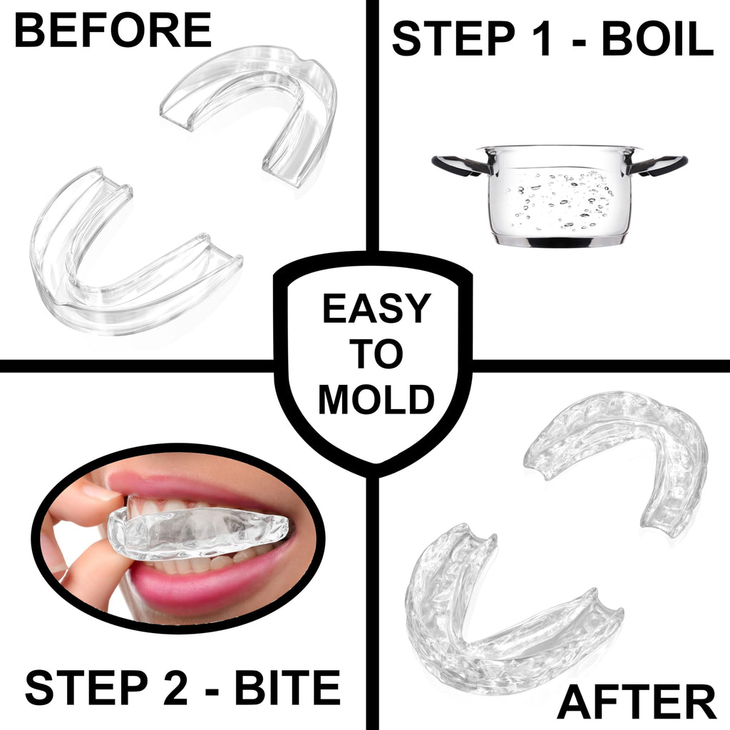 Anti Grinding Guard – Small Size for Women - Comfortable, Custom Fit, Non-Bulky, Moldable – (4) Teeth Grinding Guards & Case – Mouth Guard for Teeth Grinding, Woman Size - Small