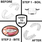 Anti Grinding Guard – Small Size for Women - Comfortable, Custom Fit, Non-Bulky, Moldable – (4) Teeth Grinding Guards & Case – Mouth Guard for Teeth Grinding, Woman Size - Small