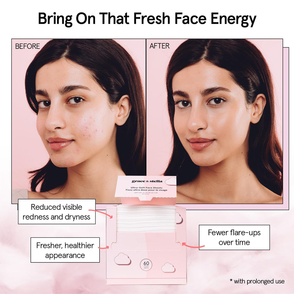 grace & stella Face Towels Disposable - Travel Essentials (60 Count) | Ultra-Soft & Absorbent Face Wipes Towelettes - XL Facial Towels for Cleansing & Makeup Removal - Lint-Free Facial Tissue