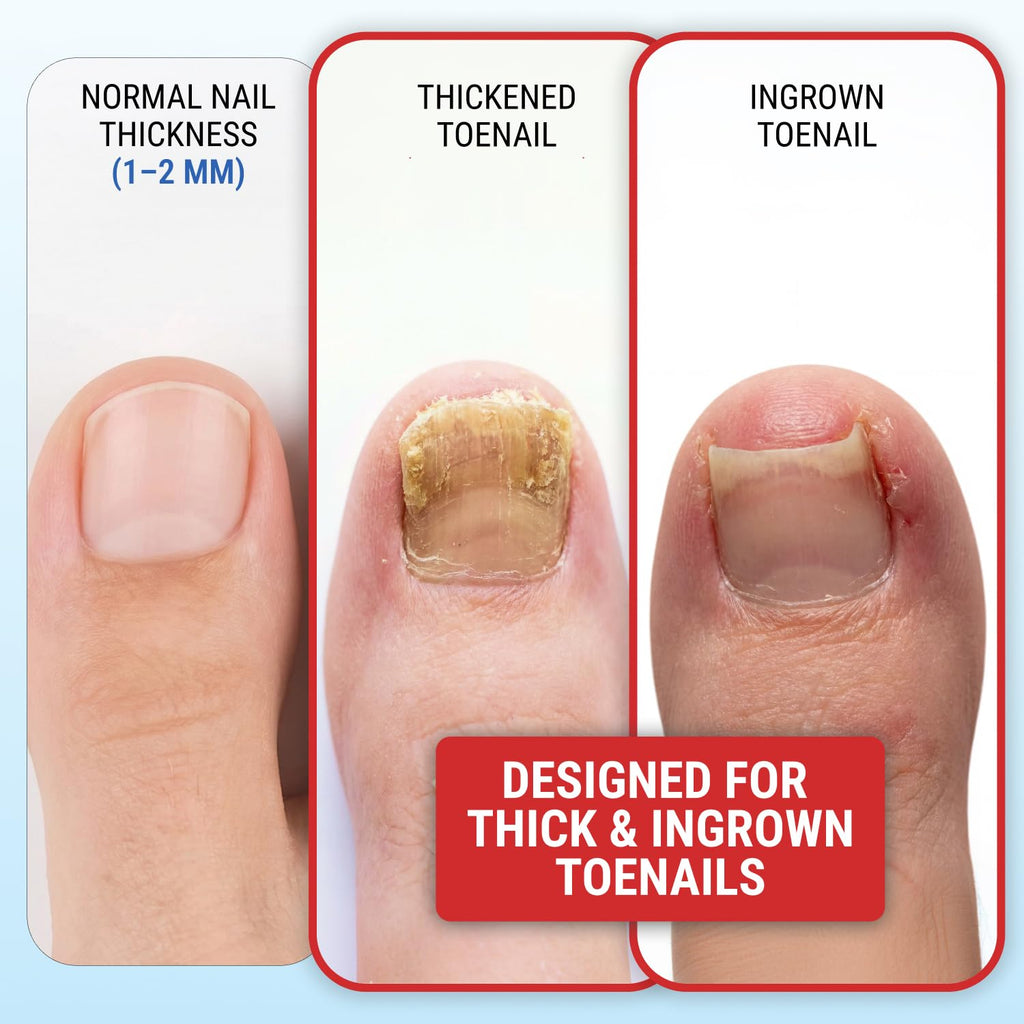 Toenail Clippers for Thick Toenails – KLIPP 15 mm Wide Jaw Thick Fingernail and Toenail Cutter with Curved Stainless-Steel Blades for Seniors (Eagle Beak)