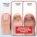 Toenail Clippers for Thick Toenails – KLIPP 15 mm Wide Jaw Thick Fingernail and Toenail Cutter with Curved Stainless-Steel Blades for Seniors (Eagle Beak)