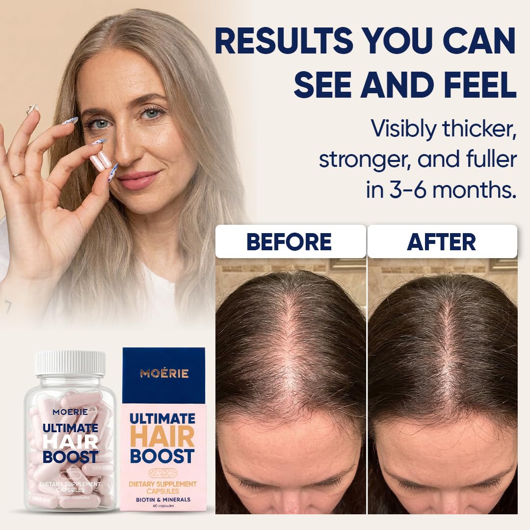 Moerie Ultimate Hair Boost Supplements for Women & Men - Hair, Skin, Nails Vitamins with Biotin & Minerals for Hair Health - Thicker Hair - 180 Capsules