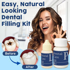 Dental Tooth Repair Kit with Zinc Oxide Eugenol Dental Cement, Temporary Filling Chips for Chipped Teeth, Loose Crowns, Cavities & Minor Tooth Repairs, Temporary Teeth Fix