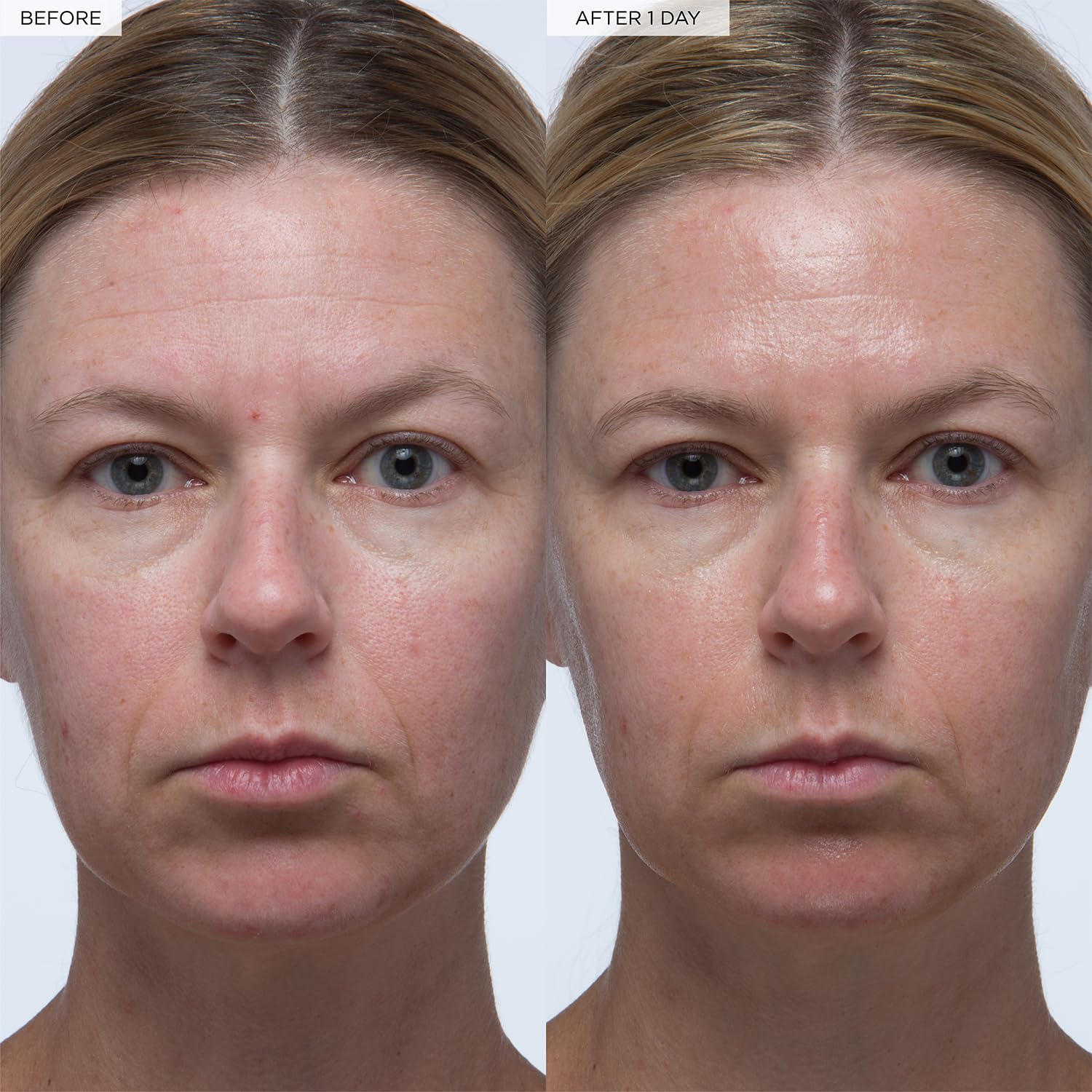 Buy now Glow Recipe Plum Plumping & Hydrating Hyaluronic Acid Korean Skin Care Serum - Antioxidant Anti Aging Face Serum + Vitamin B5 for Lasting Skin Barrier Repair & Firming Lines & Wrinkles - Vegan, 30ml at indiglob india