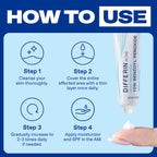 Differin Acne Spot Treatment, Max Strength, 10% Benzoyl Peroxide, 1 fl oz | Fast-Acting Pimple Treatment, Maximum Strength OTC Formula, Clears Acne Overnight, For Face, Dermatologist Brand