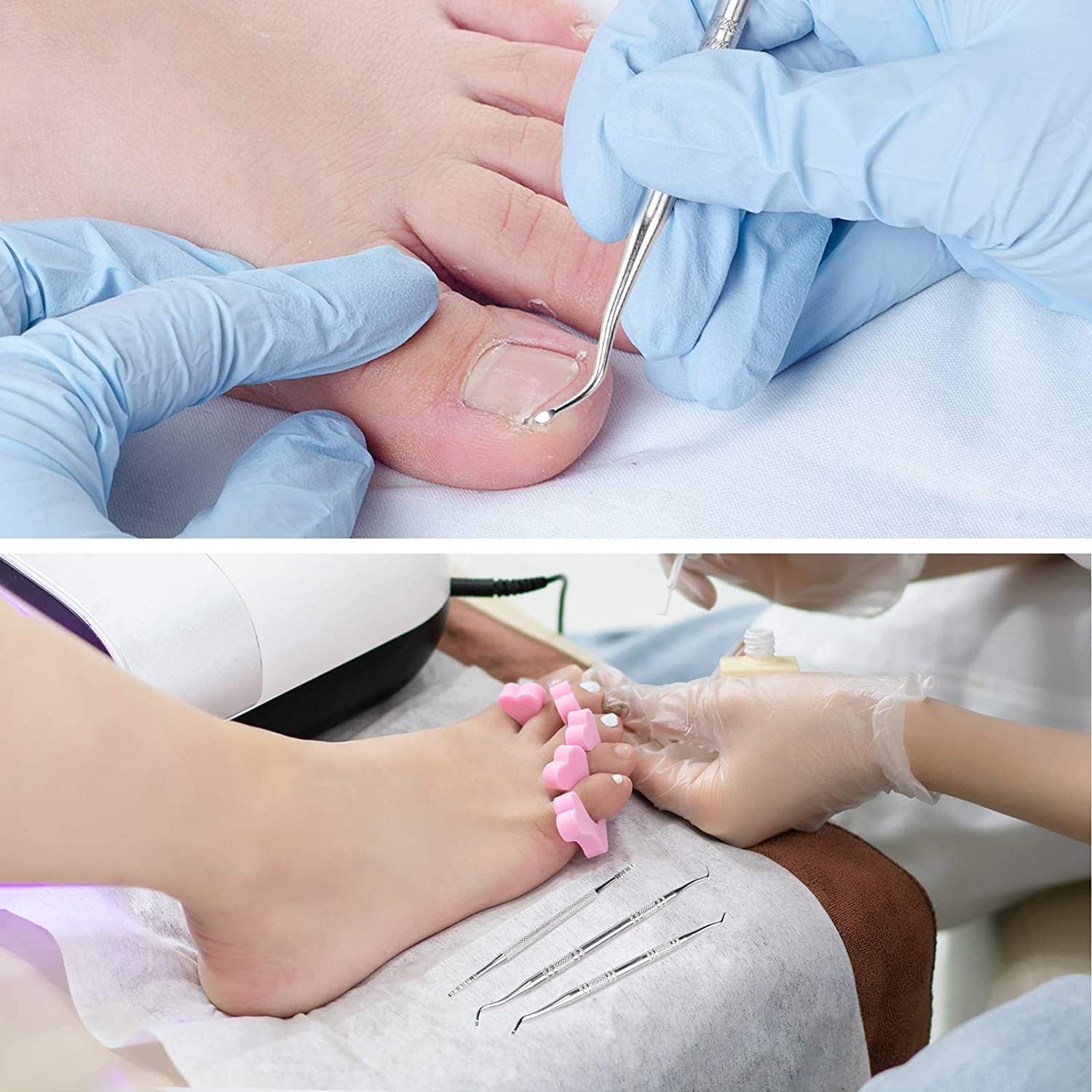 Buy now 3-Pack Ingrown Toenail File and Lifters, Professional Surgical Stainless Steel Ingrown Toenail Tool- Safe Nail Cleaning Treatment Pedicure Tools Kit Under Sidewall Cleaner Pain Relief Accessories at indiglob india