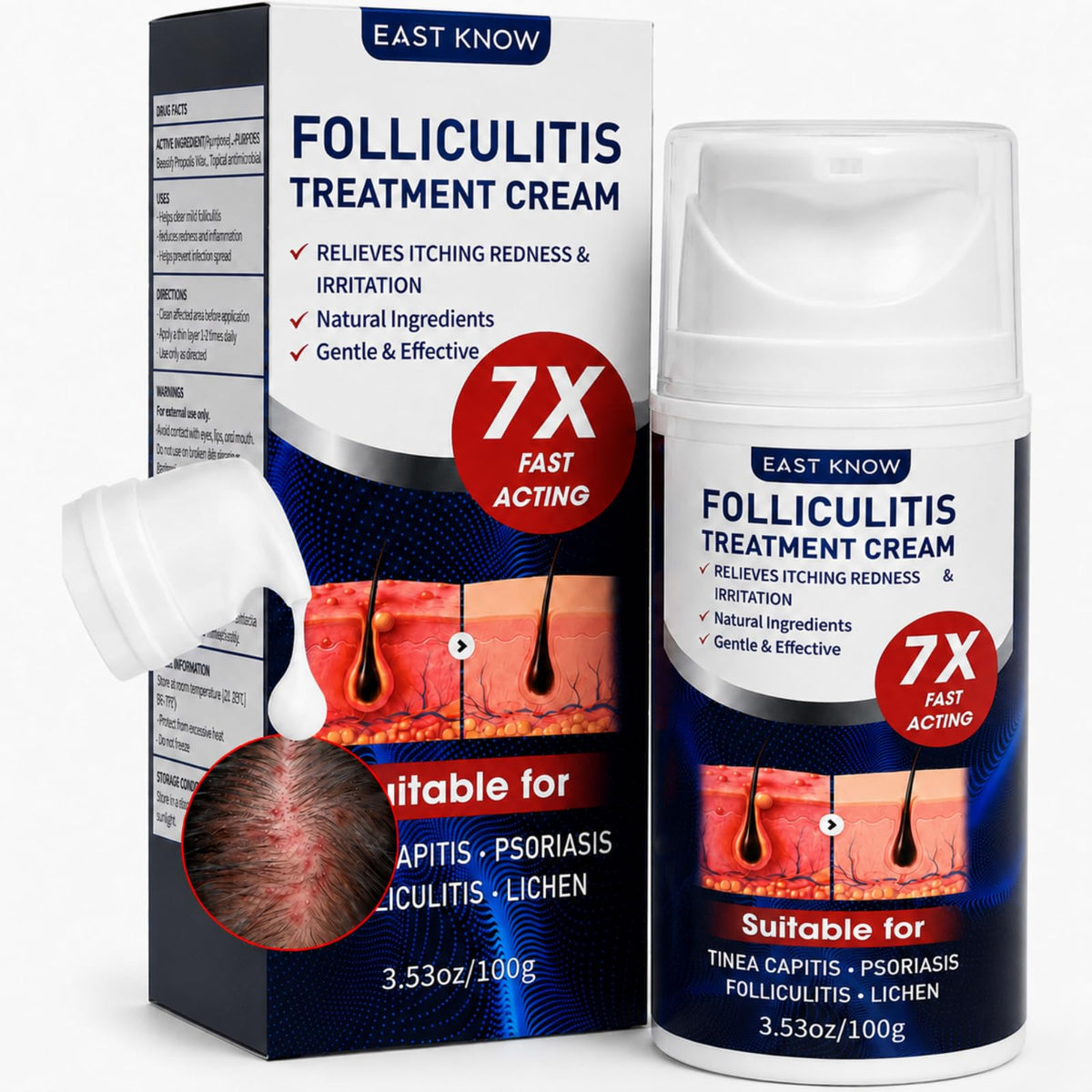 Folliculitis Treatment Cream, 5% Benzoyl Peroxide & Tea Tree Oil, 100g