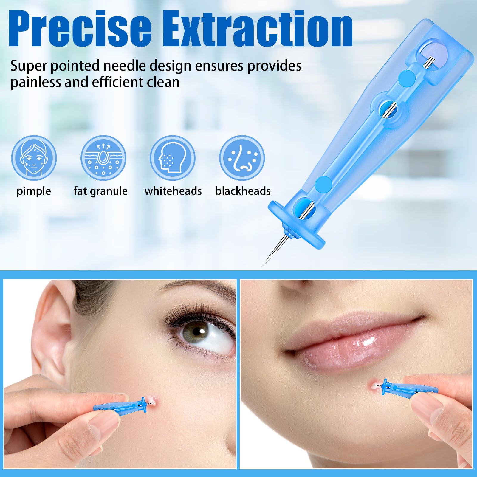 Lancets for Facial Extraction, 100Pcs Disposable Acne Needle | Effective Blemish and Blackhead Removal Tools for Clear Skin