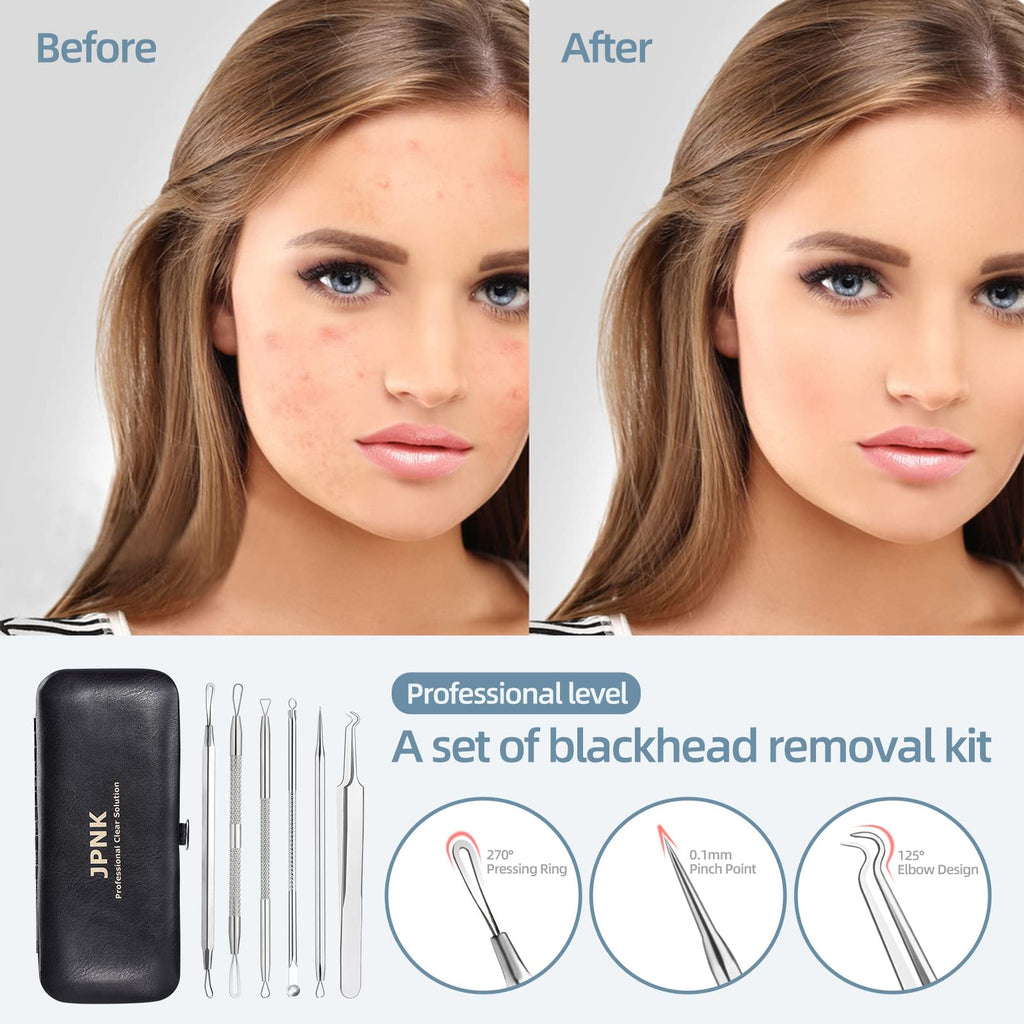 Blackhead Remover Comedone Extractor Acne Removal Kit..