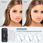 Blackhead Remover Comedone Extractor Acne Removal Kit..
