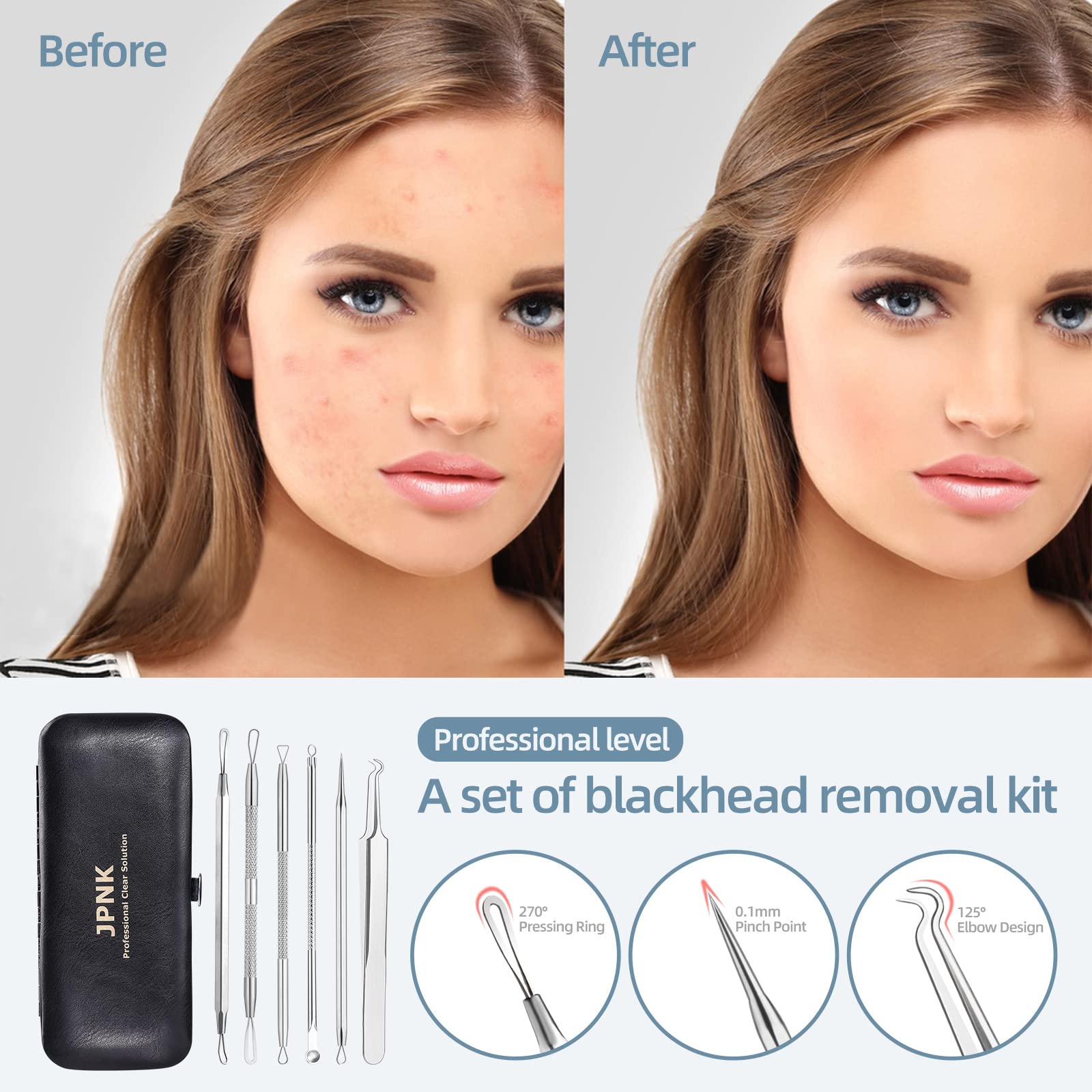 Blackhead Remover Comedone Extractor Acne Removal Kit..