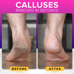NYK1 RUSTPROOF Foot File Callus Remover for Feet with Catcher | XL Size | MegaFile Hard Skin Remover Foot Scraper for Wet and Dry Use - Non-Slip Textured Grip for Smooth, Soft & Callus-Free Feet
