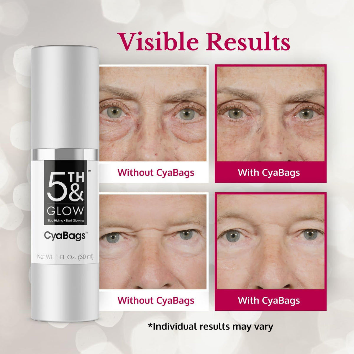 CyaBags - Instant Puffy Under Eye Bag Remover Cream for Women - Vitamin C