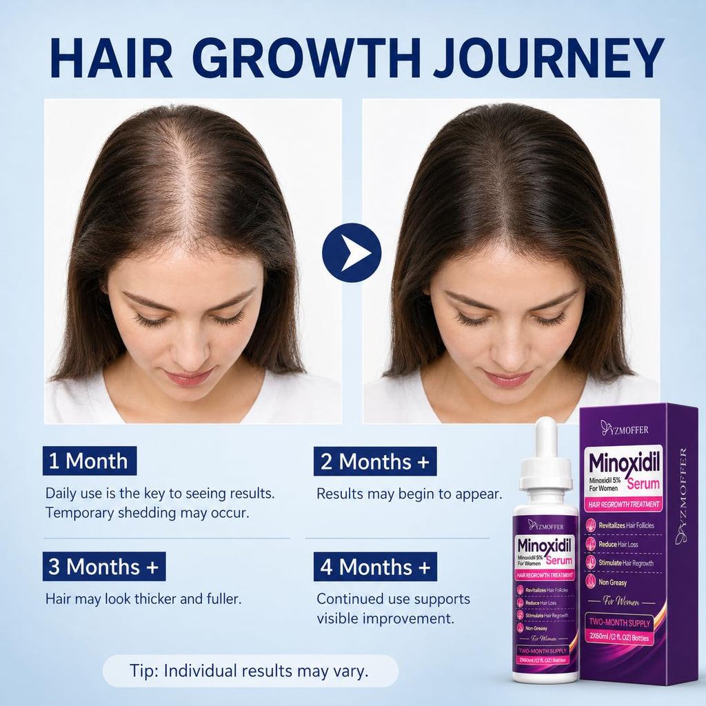 Minoxidil 5% Hair Regrowth Treatment for Women, 2-Month Supply | Topical Serum Drops for Thinning Hair, Revitalizes Hair Follicles, Reduces Hair Loss, Non-Greasy Liquid Formula