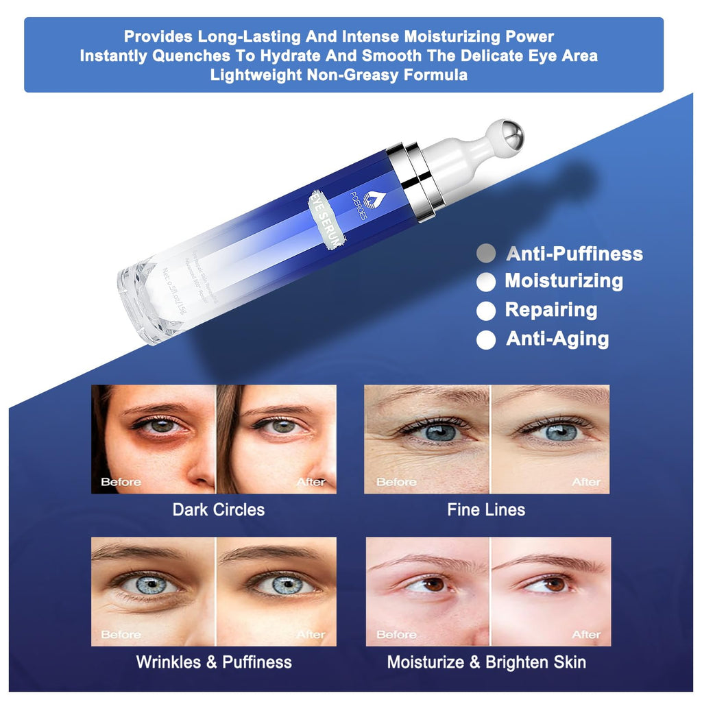 Eye Serum with 8% Caffeine & 8% Retinol Under Eye Cream 0.5 Fl Oz | Hyaluronic Acid Niacinamide & Peptides 360° Cooling Roller for Dark Circles Puffiness Fine Lines & Wrinkles,