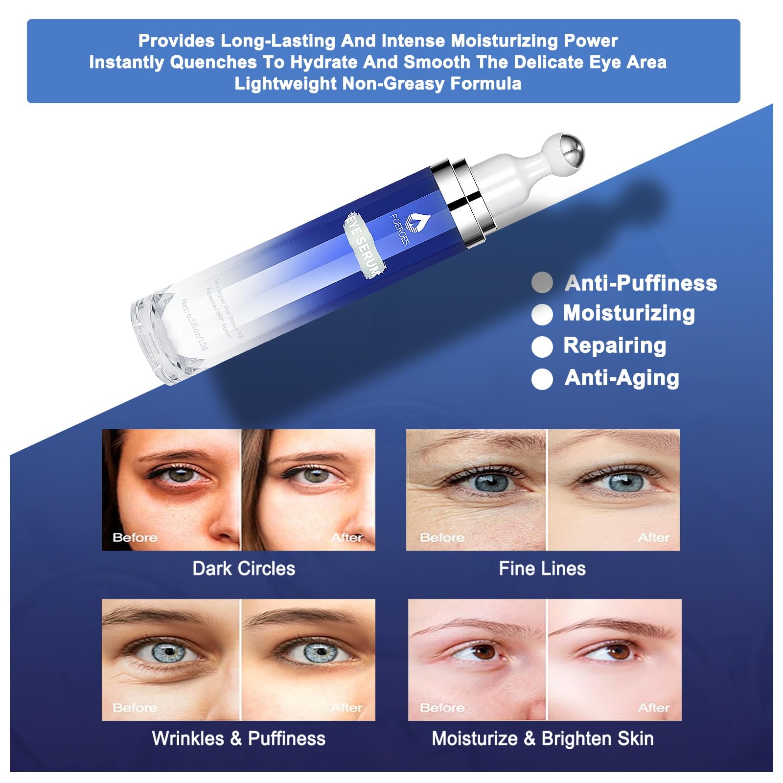 Eye Serum with 8% Caffeine & 8% Retinol Under Eye Cream 0.5 Fl Oz | Hyaluronic Acid Niacinamide & Peptides 360° Cooling Roller for Dark Circles Puffiness Fine Lines & Wrinkles,