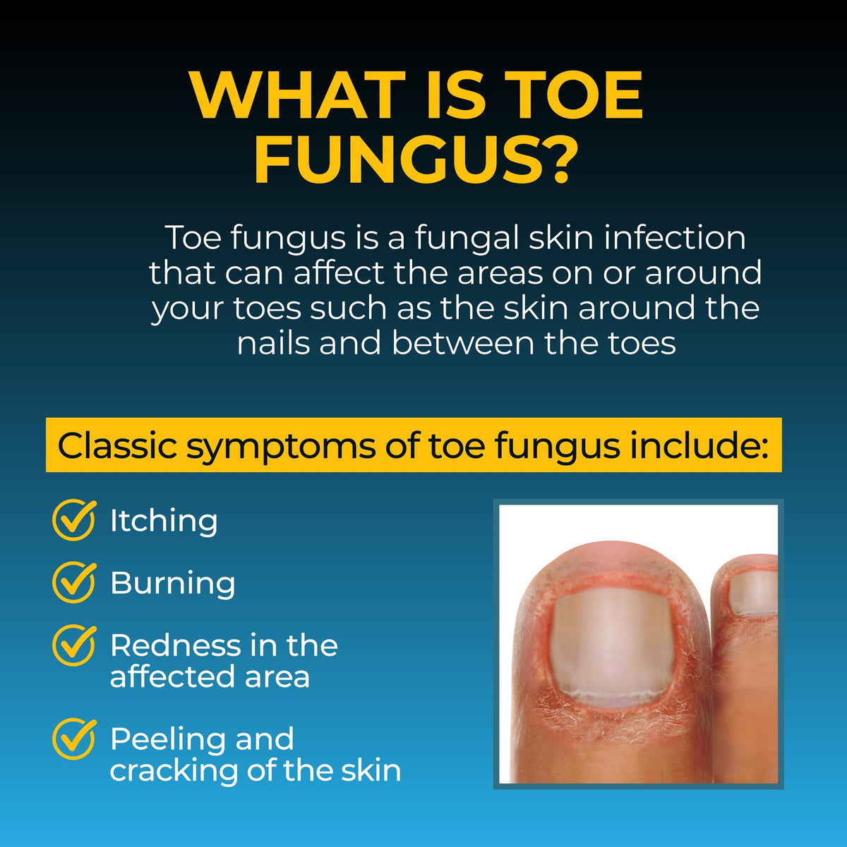 Fungi-Nail Anti-Fungal Foot Spray, 1oz