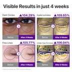 numbuzin No.9 NAD+ Retinol Eye Cream for Dark Circles, Puffiness, Crow's Feet with 50 Peptides, 4% Niacinamide & Ceramide, Reduces Wrinkles & Fine Lines, korean eye cream, 0.33 fl oz