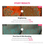 APRILSKIN TXA Niacinamide Toning Shot 99 Spicule Facial Serum｜Skin Booster Serum for Brightening and Pore Care｜99% High-Purity Tranexamic Acid 3% + Niacinamide 5%｜Korean Skin Care｜1.01 fl. oz.