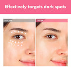 TOSOWOONG Arbutin 7% Intensive Spot Cream for Dark Spots, Freckles, Glow