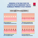 Minoxidil for Men, 2.11 Oz (1 Month Supply) Clinically Proven to Regrow Hair, Topical Aerosol Foam 5%, Hair Thinning Treatment