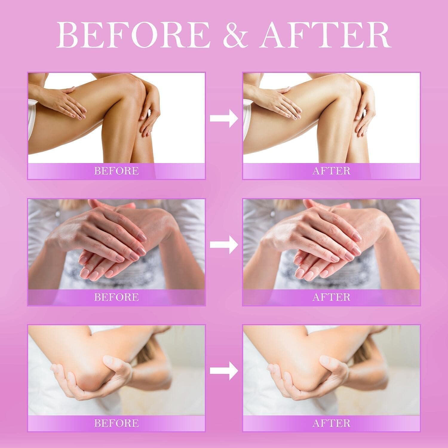 Buy now Dark Spot Corrector Cream - Underarm, Neck, Armpit, Knees, Elbows, Private Areas, Intimate Areas - Upgraded Formula, Instant Result 2 fl.oz at indiglob india