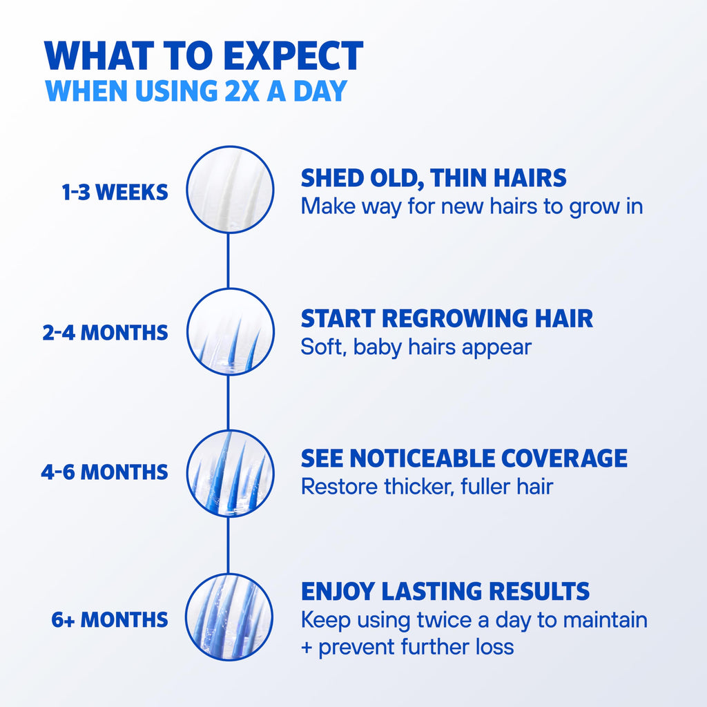 Men's Rogaine 5% Minoxidil Foam, 1-Month Supply, 2.11 oz | Fuller, Thicker Hair Regrowth, Topical Hair Loss Treatment, Unscented Topical Aerosol