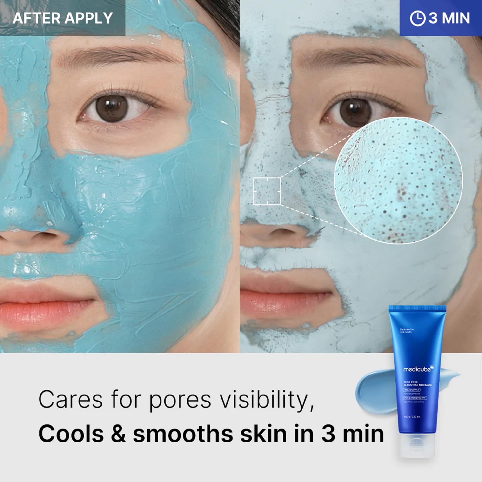 medicube Zero Pore Blackhead Mud Mask - Pore Cleansing & Gentle Exfoliating | Blackhead-Removing Clay Mask with AHA BHA PHA, Pore Minimizing & Cooling Care, 3 Min Quick Dry, Korean Skincare 3.52 oz.