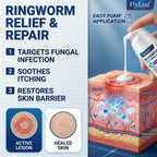 Antifungal Ringworm Treatment Cream, - Miconazole Nitrate 2% Antifungal Cream for Humans - For Fast Itch Relief, Jock Itch & Athlete's Foot - Cream with Ceramides & Tea Tree Oil, Non-Greasy, 3.53oz