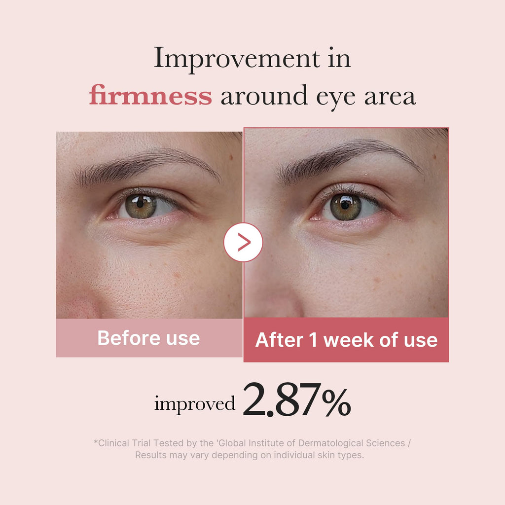medicube Eye Serum with Salmon DNA PDRN & Pink Peptides | 99% Purity Retinol for Fine Lines - PDRN & Niacinamide for Uneven Skin Tone, Korean Skincare, 1.01 fl.oz