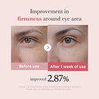 medicube Eye Serum with Salmon DNA PDRN & Pink Peptides | 99% Purity Retinol for Fine Lines - PDRN & Niacinamide for Uneven Skin Tone, Korean Skincare, 1.01 fl.oz