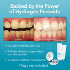 Perio Gel | Periodontal Treatment for Teeth | Promotes Teeth Whitening (3 oz.)