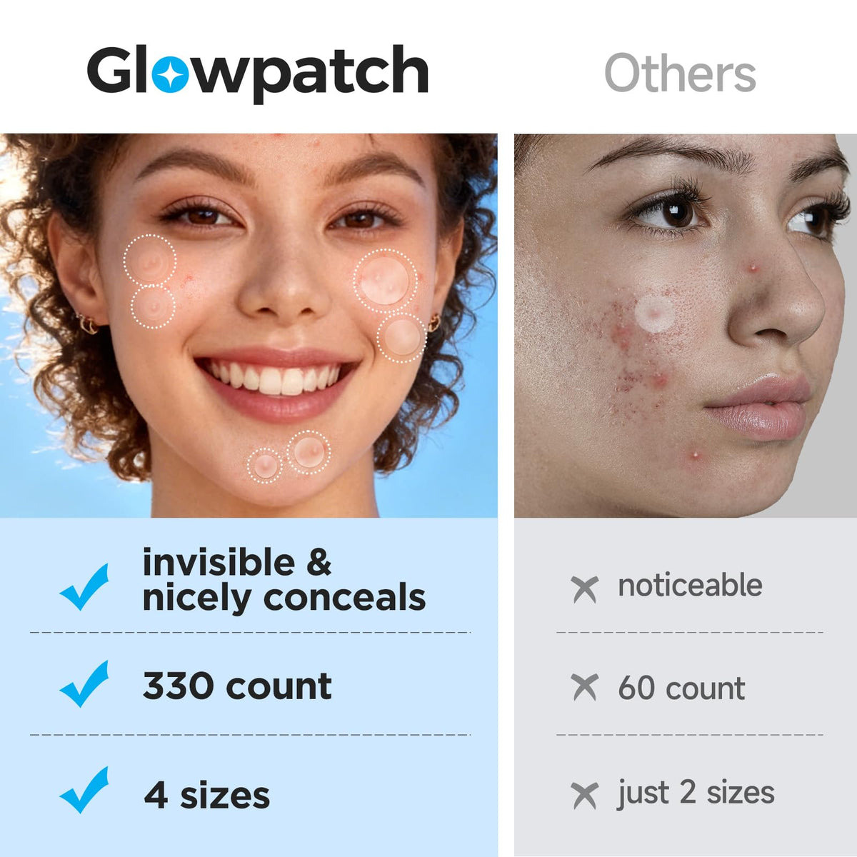 Invisible Pimple Patches for Face, Day & Night Acne Cover 330 Ct